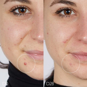 CAUDALIE Vinopure Serum Gegen Unreinheiten 30 Ml 6 CAUDALIE Vinopure Serum Gegen Unreinheiten 30 Ml – Bild 4